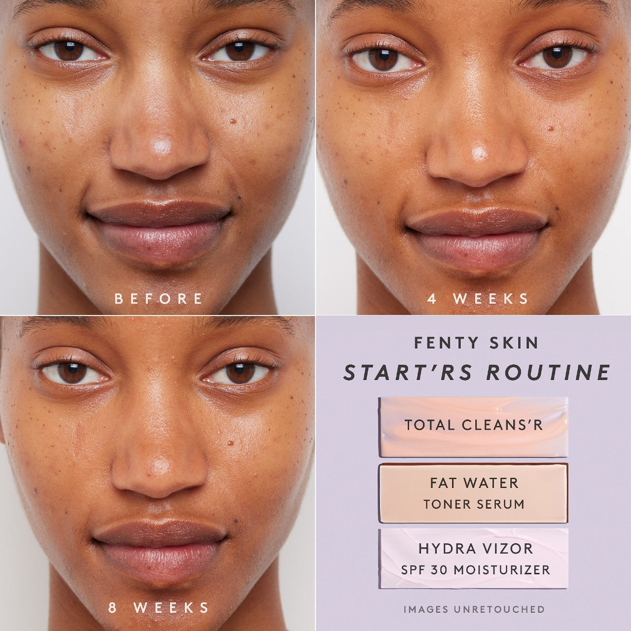Fat Water Niacinamide Pore-Refining Toner Serum with Barbados Cherry
